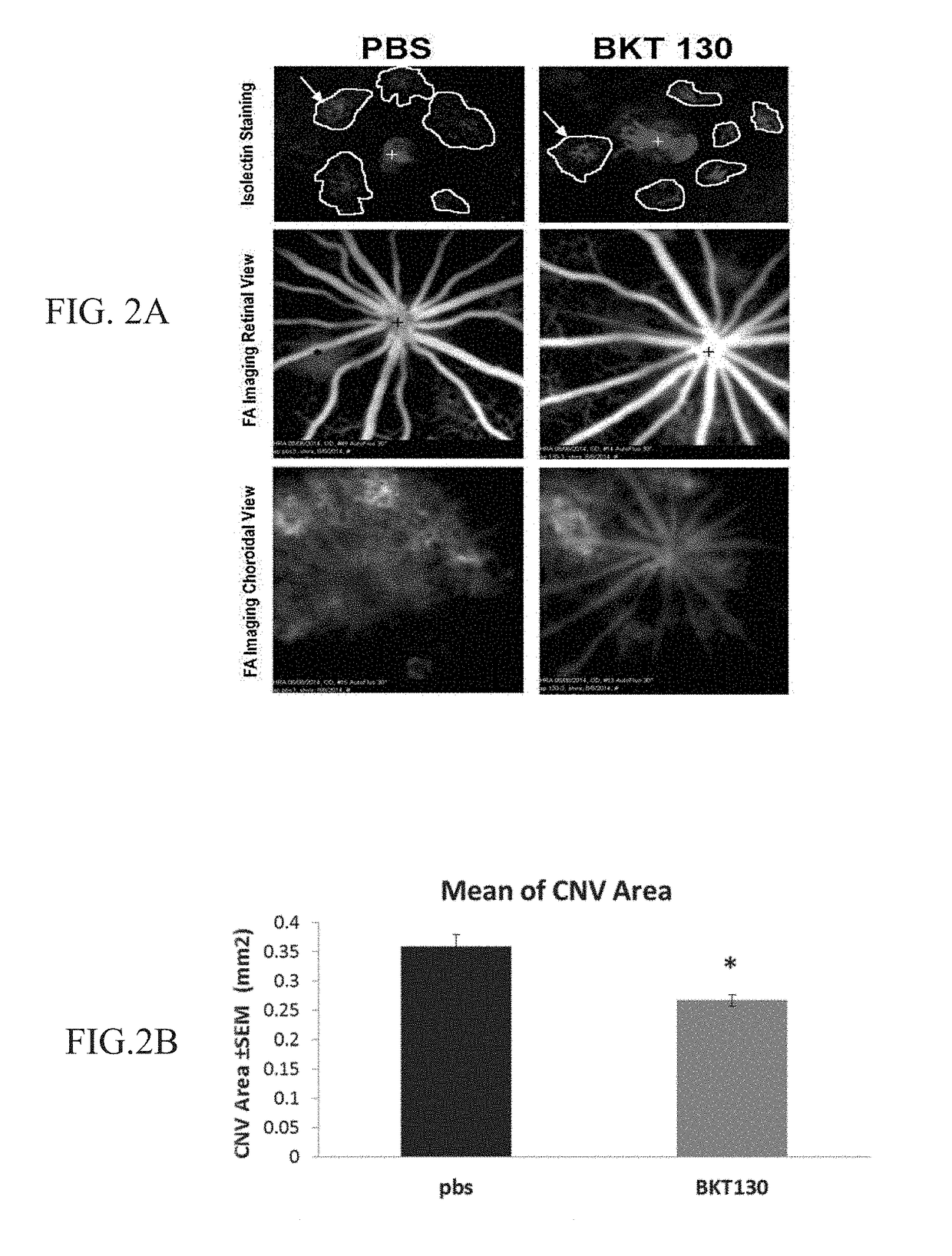 Compositions and methods for the treatment of ocular diseases