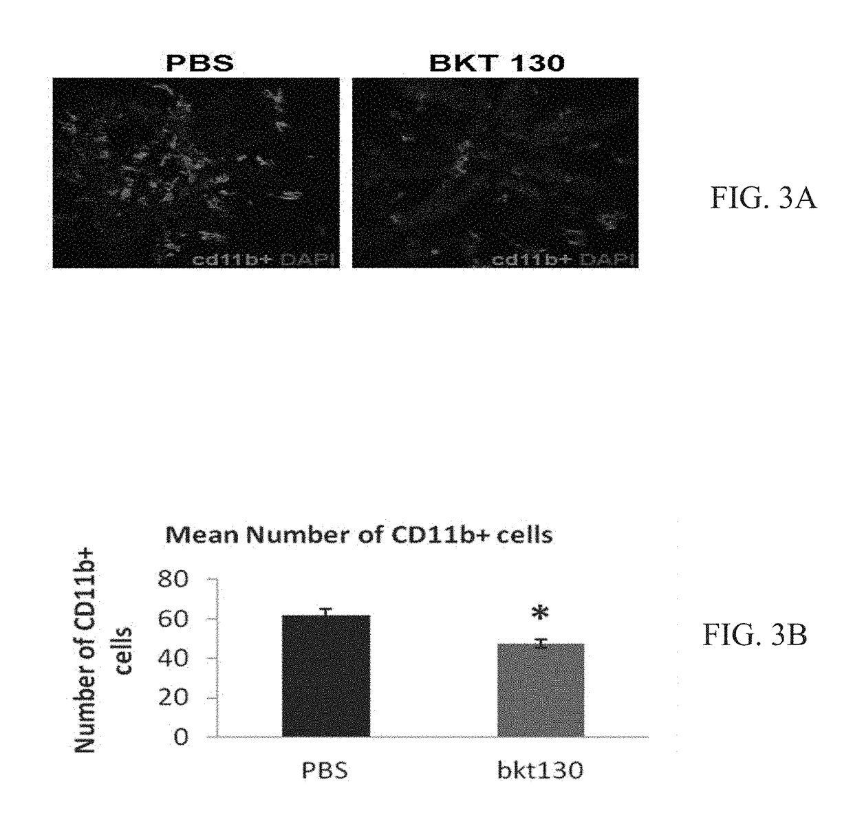 Compositions and methods for the treatment of ocular diseases