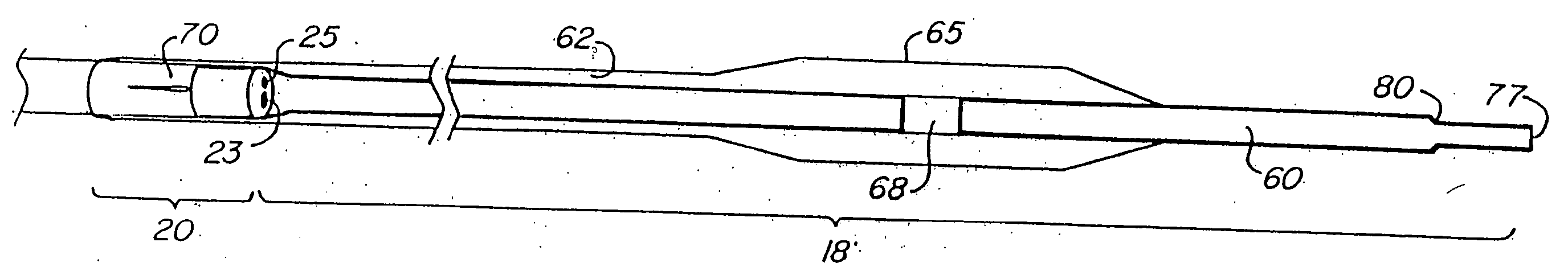 Catheter system having a balloon angioplasty device disposed over a work element lumen