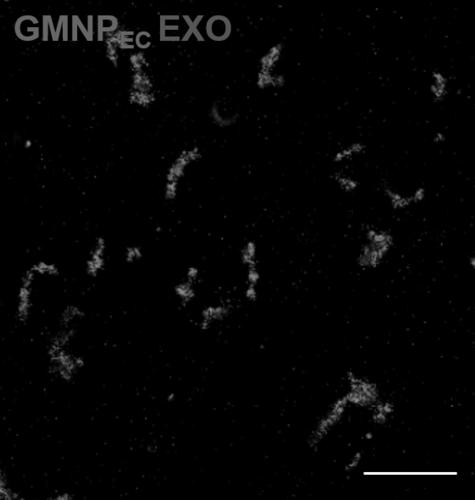 Magnetic nanoparticle