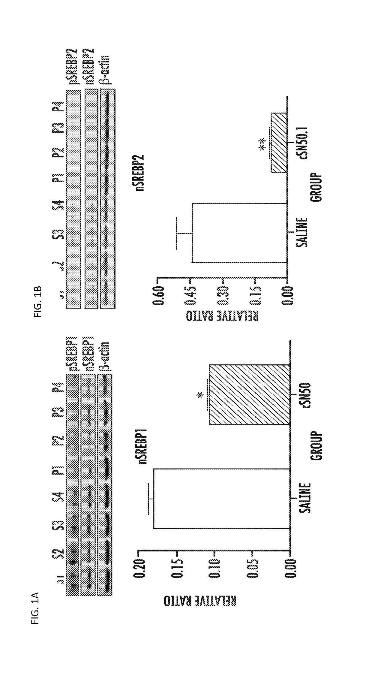 Compositions and methods for treating and preventing hyperlipidemia, fatty liver, atherosclerosis and other disorders associated with metabolic syndrome