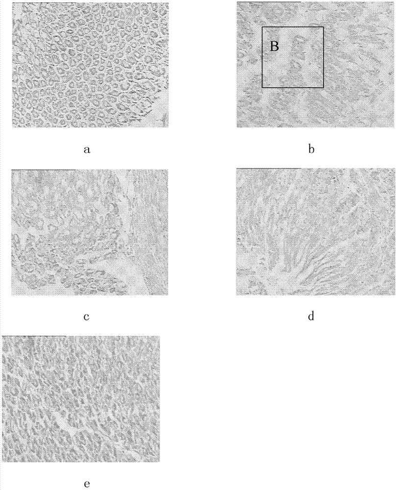 Composite aqueous extract of Fu brick tea and application thereof