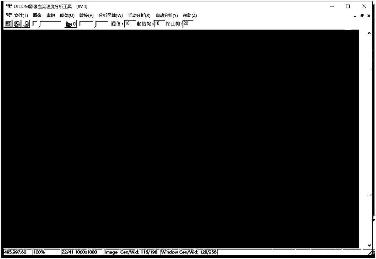 A dicom image blood flow analysis system