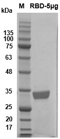 Gene of novel coronavirus B.1.1.7 British mutant strain RBD and application of gene