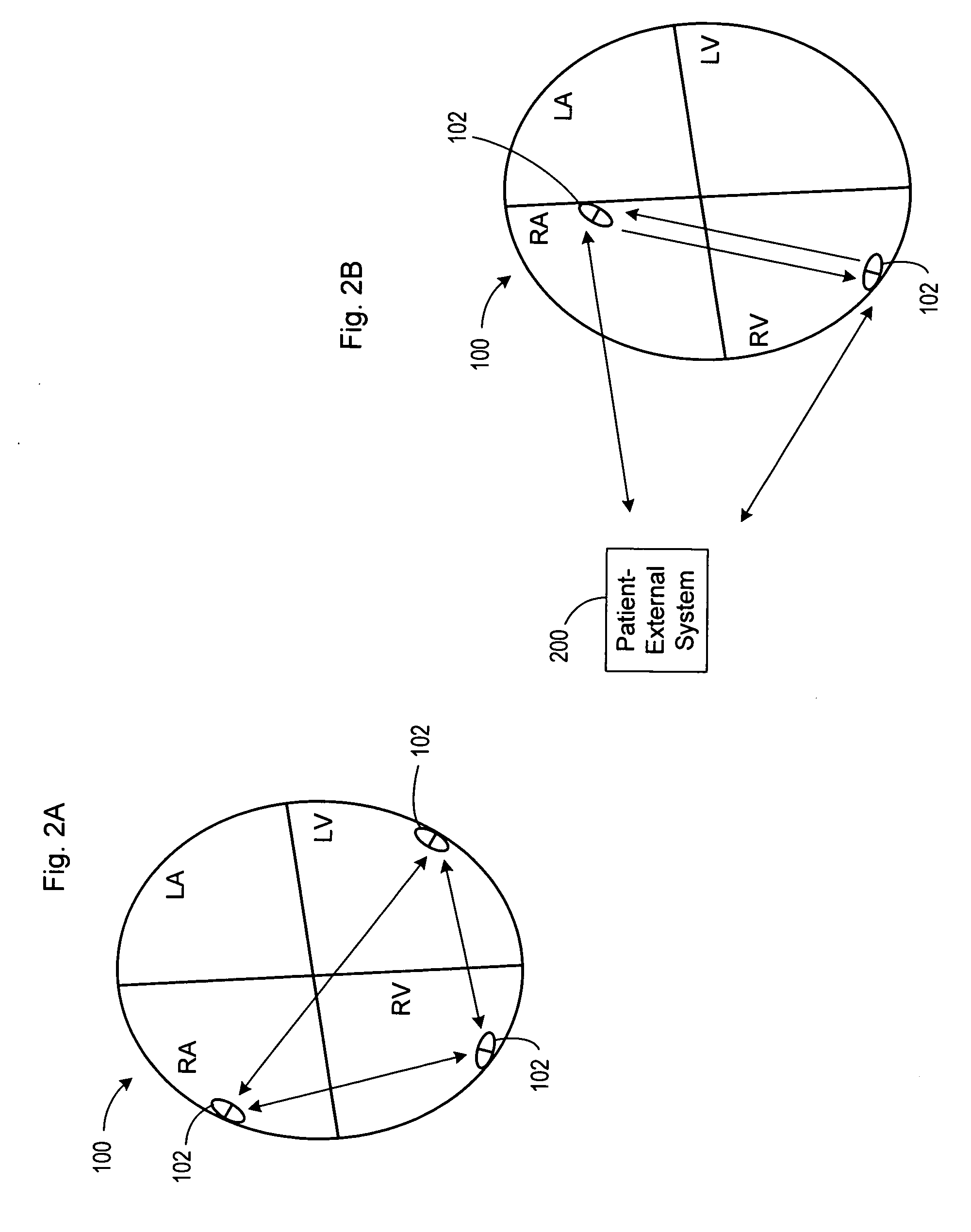 Leadless cardiac stimulation device employing distributed logic