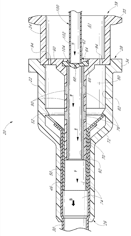 Catheter aseembly blood control device and related methods