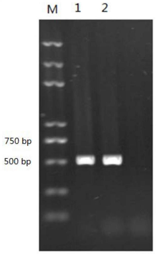 A sarcocystis fusion antigen, coding gene, indirect ELISA antibody detection kit and application thereof