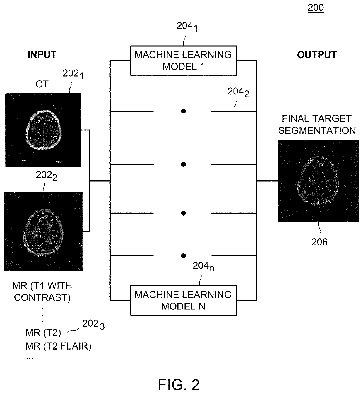 Method and apparatus for automated target and tissue segmentation using multi-modal imaging and ensemble machine learning models