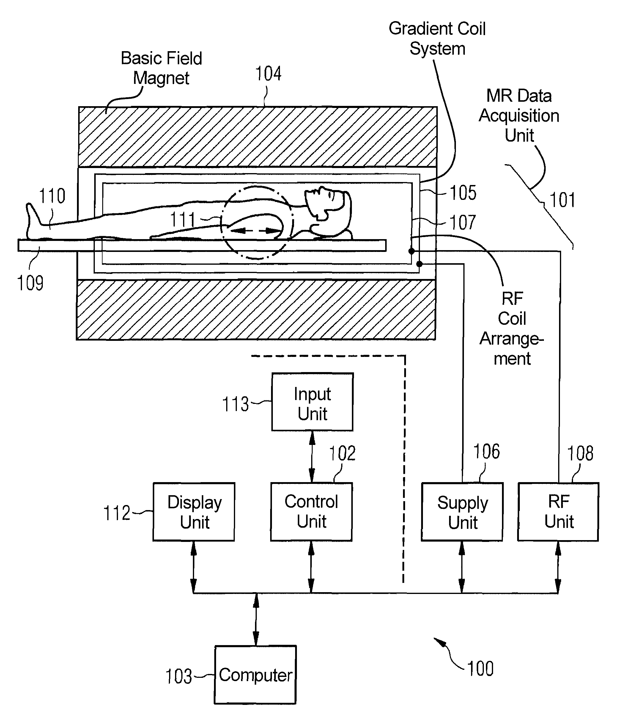 Angiographic method and apparatus allowing identification of contrast agent propagation