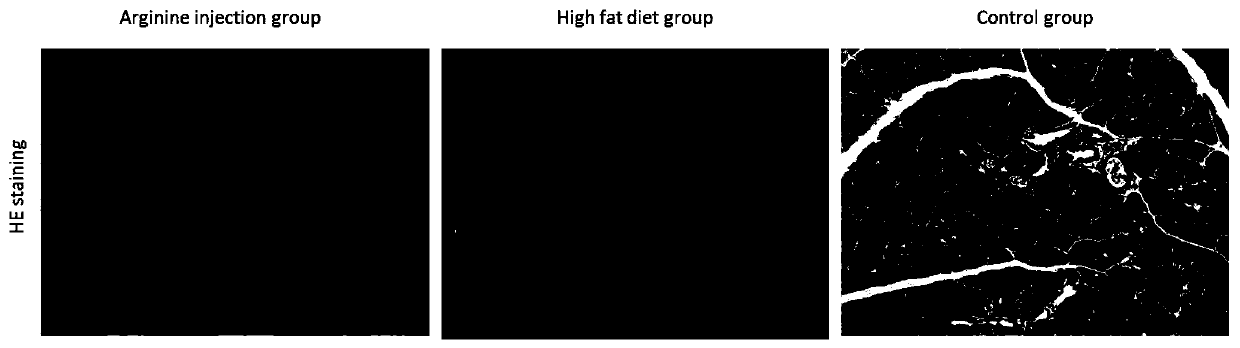 Method for measuring regulation and control of Chemerin on insulin resistance and intervention of CMKLR1 agonist