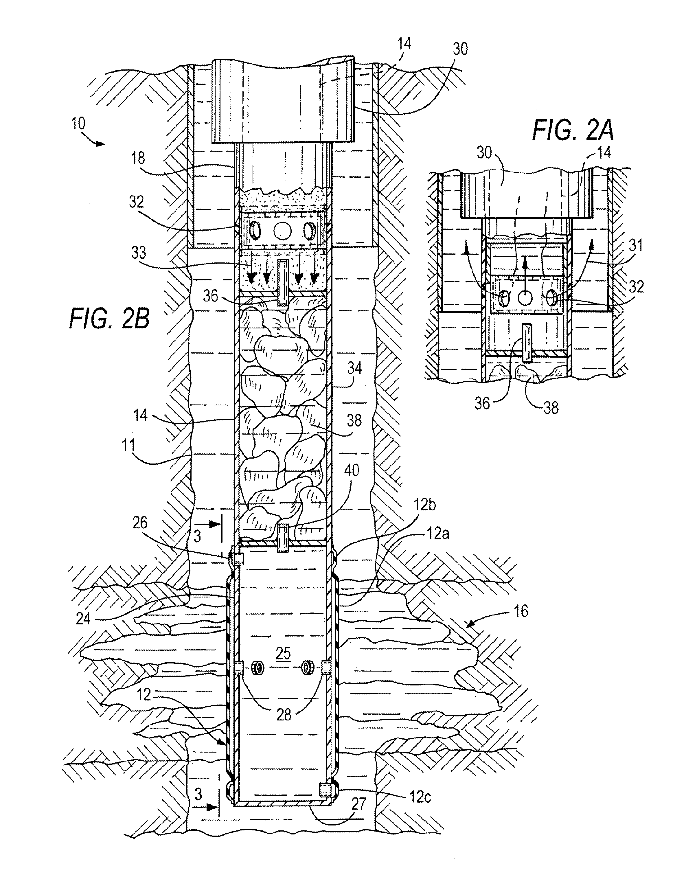 Method and apparatus for sealing an undesirable formation zone in the wall of a wellbore