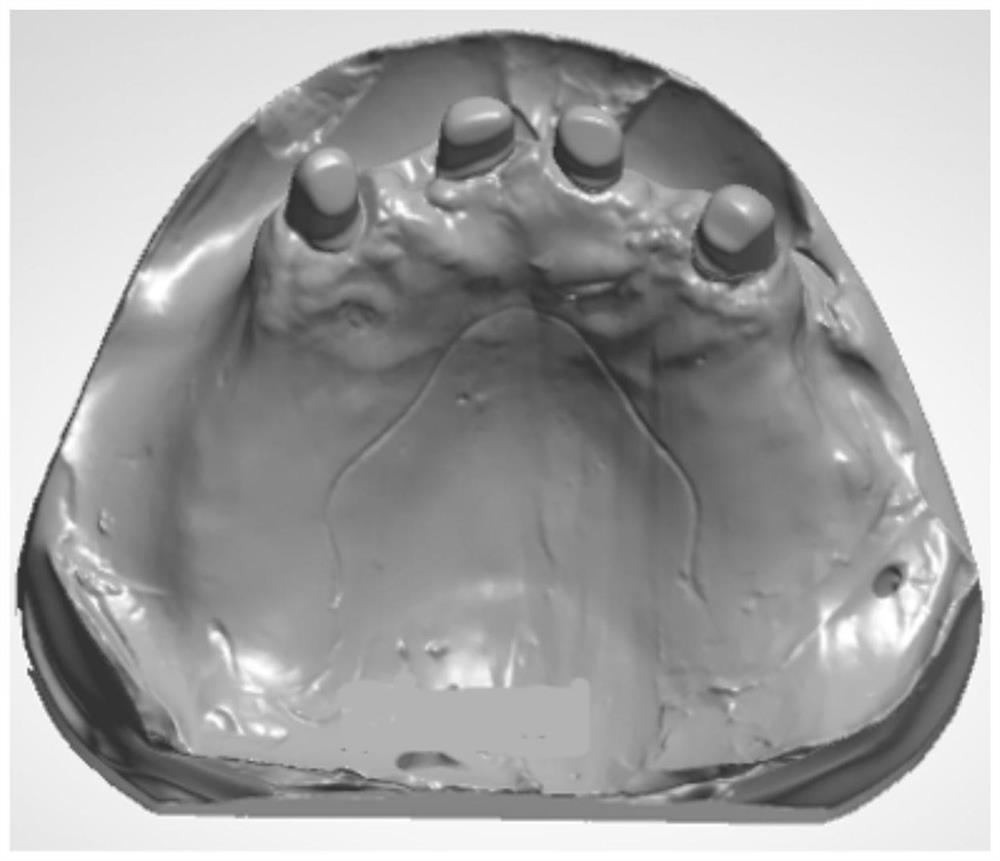 Telescopic crown retainer based on 3D printing and manufacturing method thereof