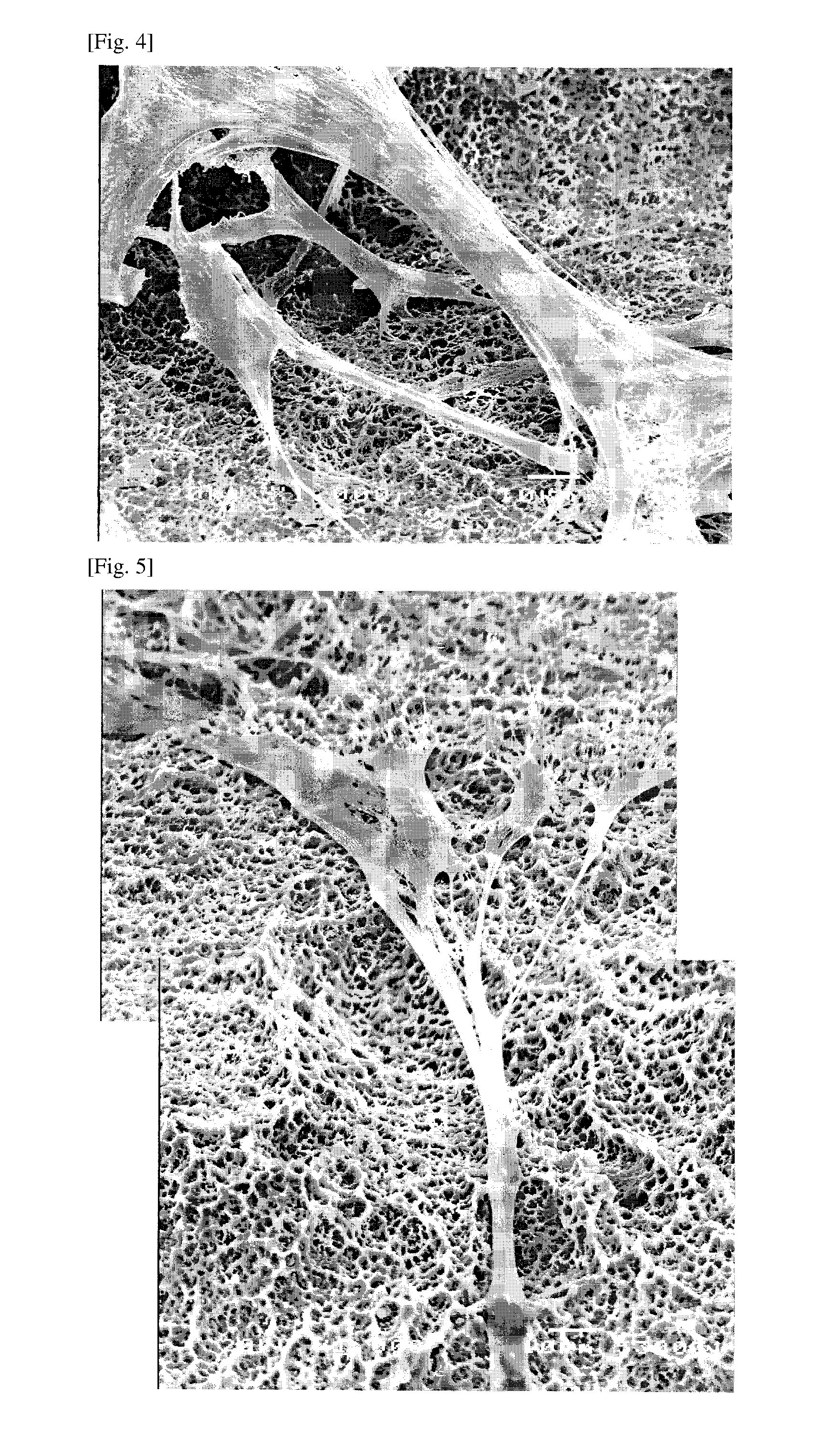 Surface-modified hybrid surface implant and method for  manufacturing the same