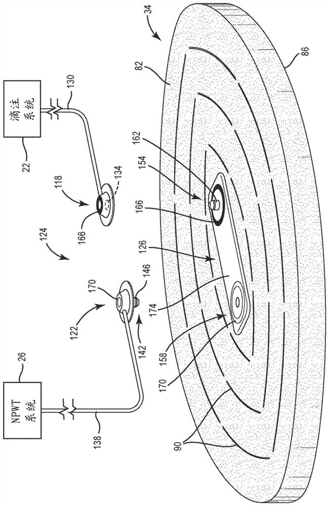 Systems and methods for managing pneumatic pathways in integrated multilayer wound dressings