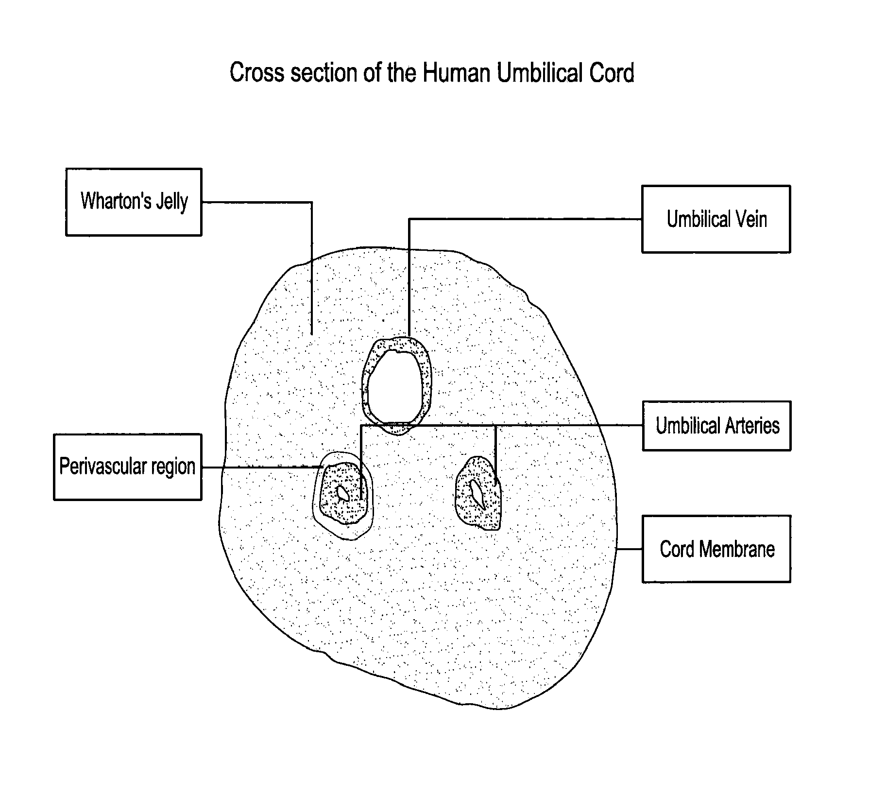 Methods for isolating mononuclear cells that include a subpopulation of mesenchymal progenitor cells and vascular cells that include a subpopulation of endothelial progenitor cells from umbilical cord tissue