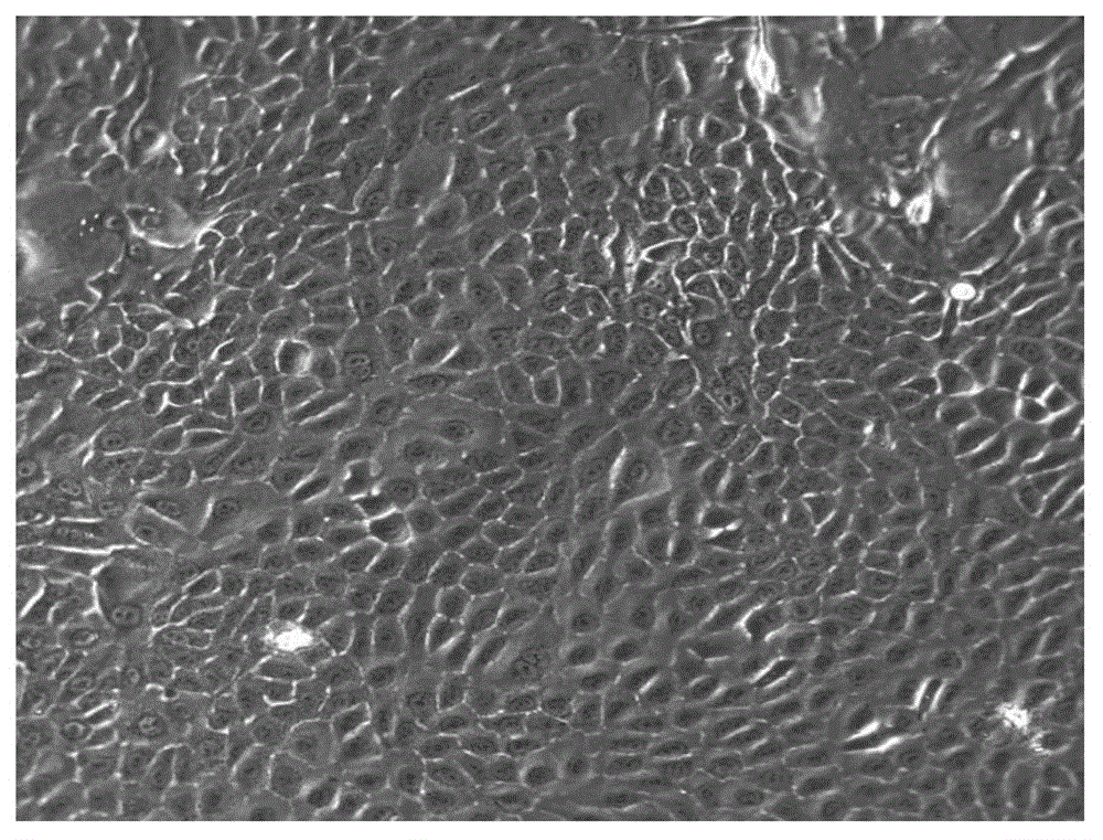 Human prostate cancer cell and its primary isolation culture and subculture method and application