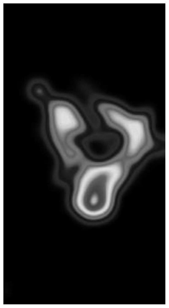 A Semantic Segmentation Method for Masses in Mammography Images Based on Deep Residual Networks