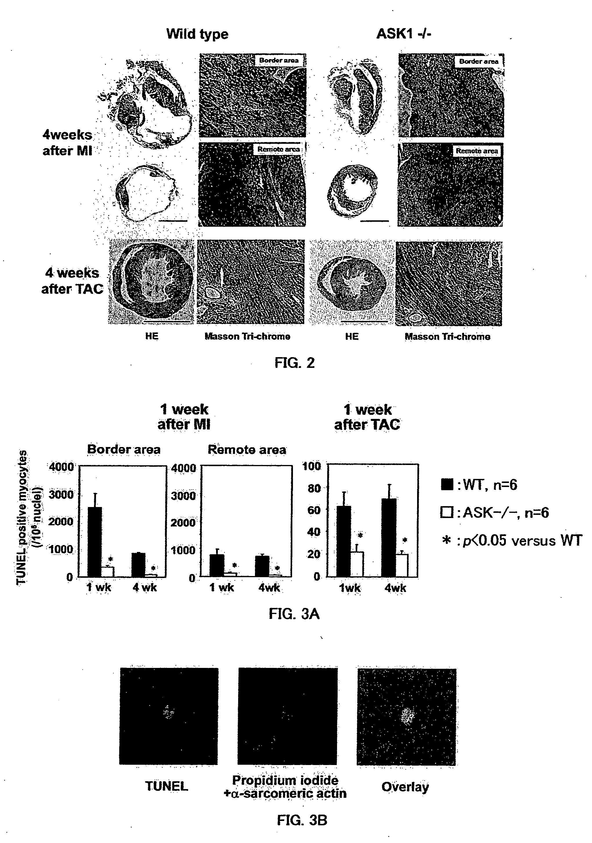 Remedy for cardiac failure containing ask1 inhibitor as active ingredient and method for screening the same