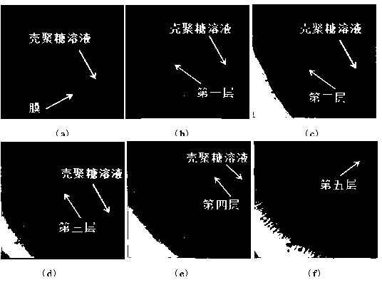 Chitosan multilayered gel balls and preparation method thereof