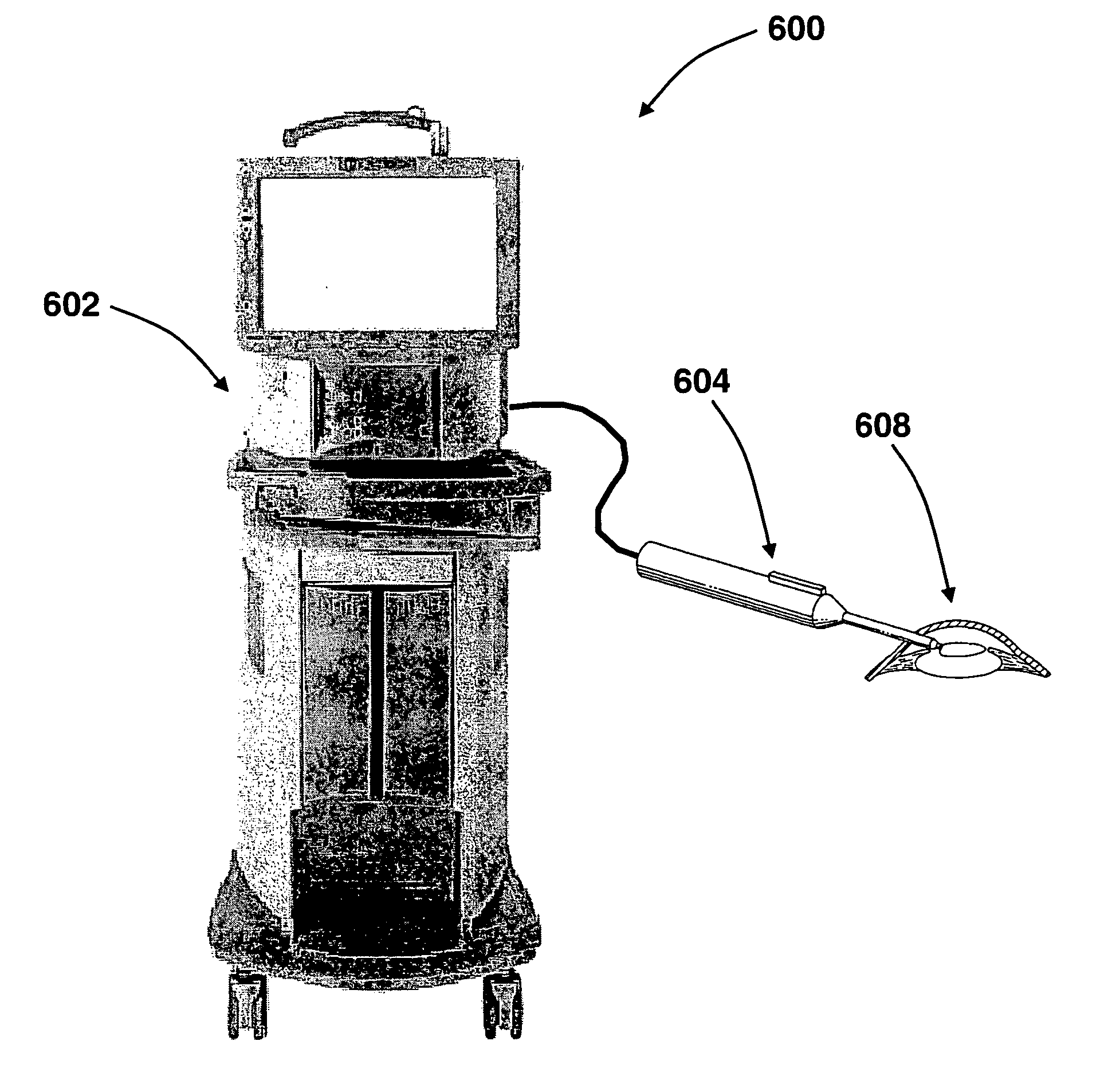 Application of a system parameter as a method and mechanism for controlling eye chamber stability