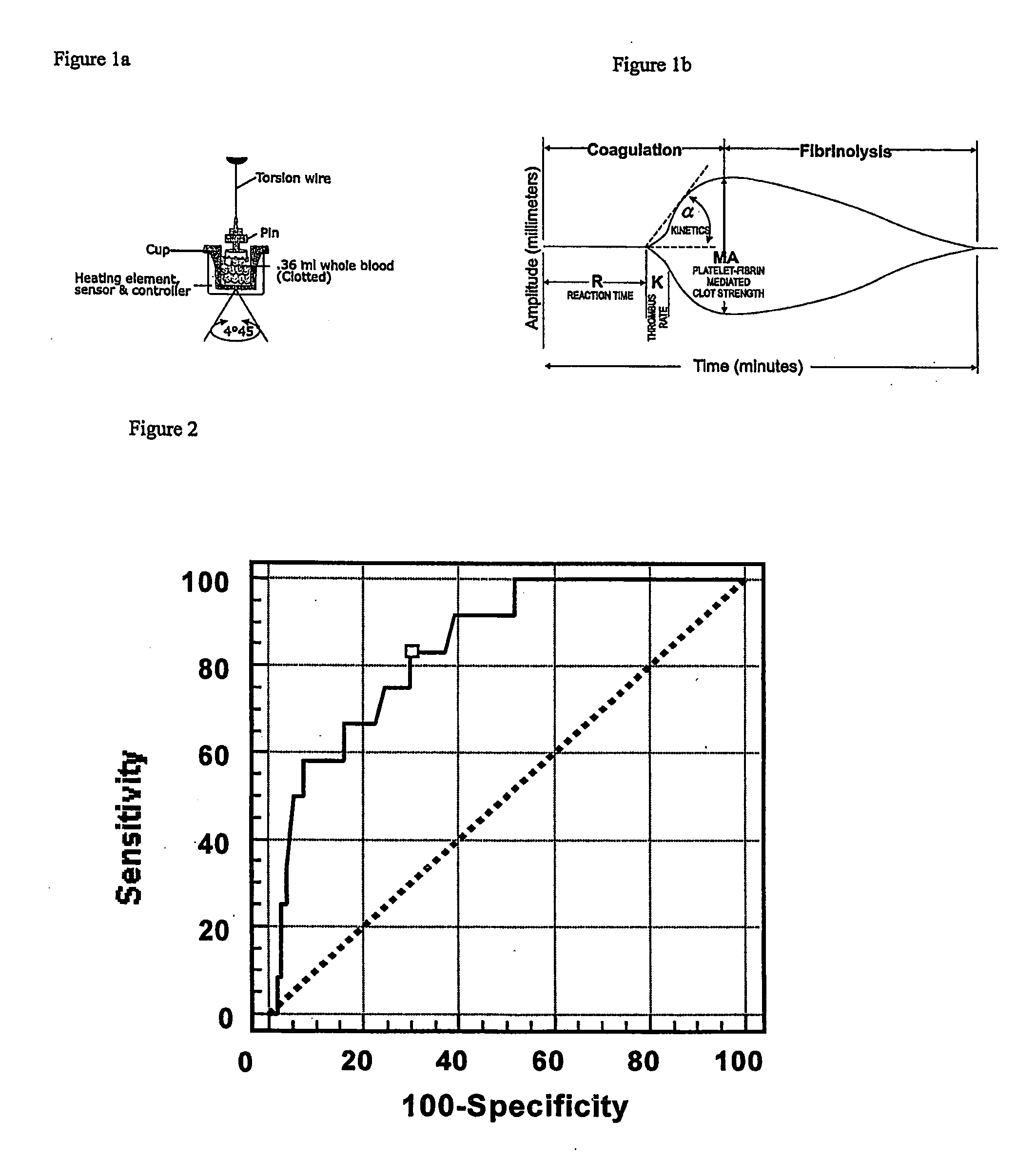 Detection of restenosis risk in patients receiving a stent by measuring the characteristics of blood clotting including the measurement of maximum thrombin-induced clot strength