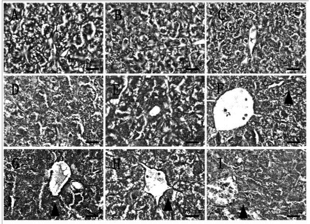 Method for establishing iron-overload mouse model corresponding to thalassemia Pesaro risk classification