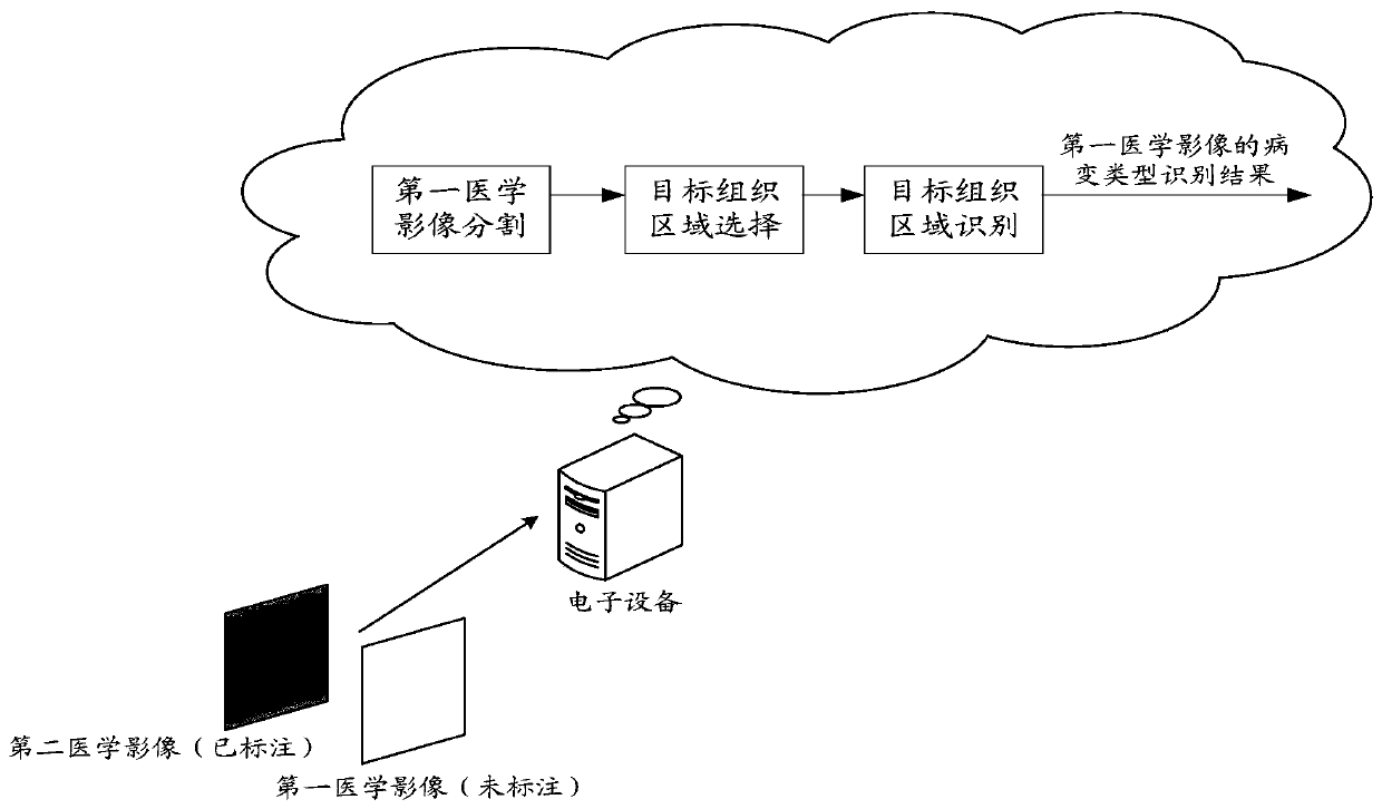 Medical image recognition method and device, electronic equipment and storage medium