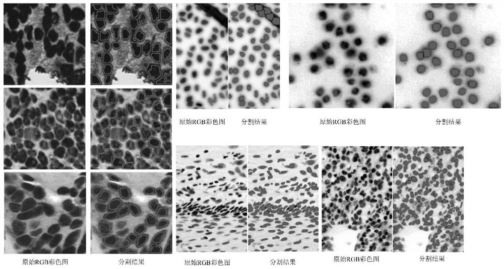 Cell segmentation method, device and computer-readable storage medium