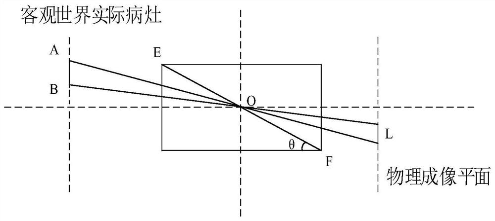 Lesion size measurement method, system and computer equipment for fluorescence endoscopy