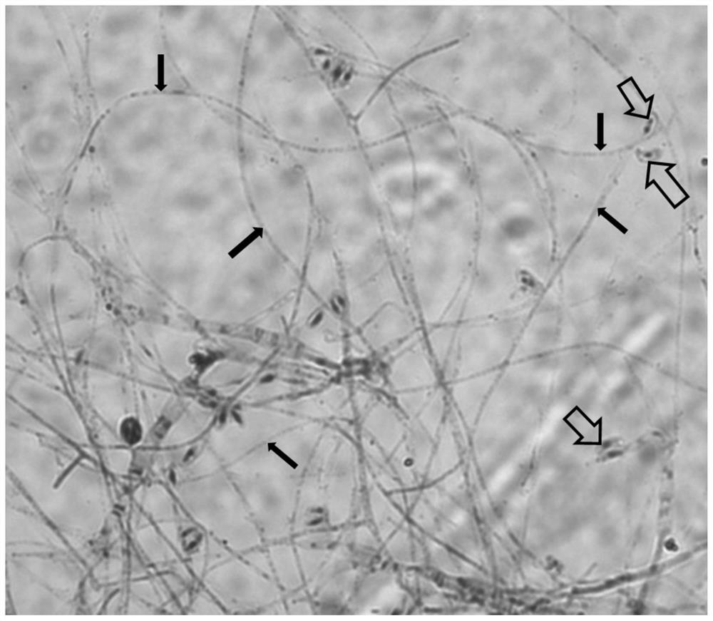 Culture method of high-infectivity cordyceps sinensis strain and application thereof