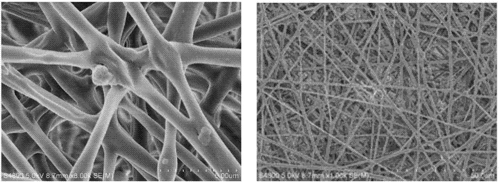 Polylactic acid / beta-calcium phosphate / I type collagen composite nerve conduit and preparation method thereof