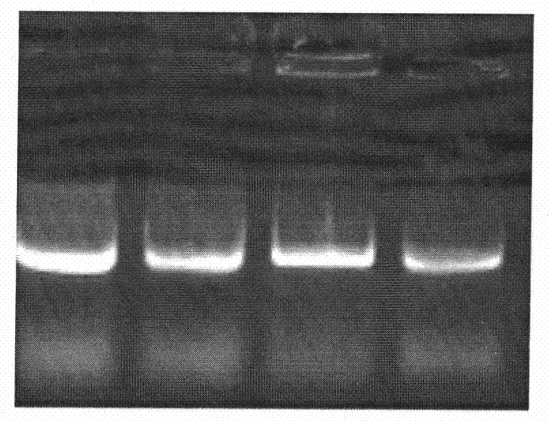 Human genetic engineering antibody TRD 109 as well as preparation method and application thereof