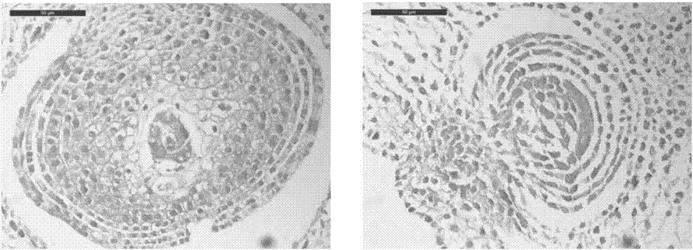 Method for observing Tilletia controversa Kuhn (TCK) infected Triticum aestivum ovaries