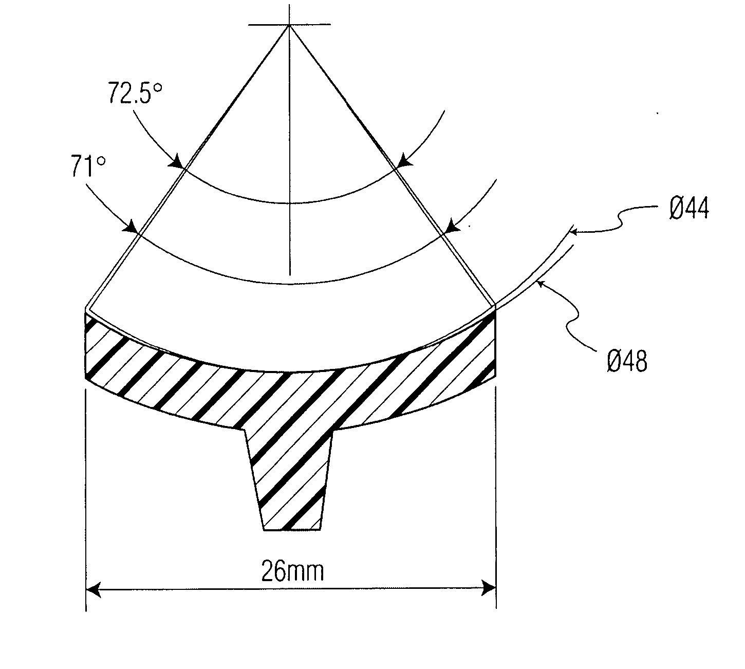 Prosthetic glenoid component