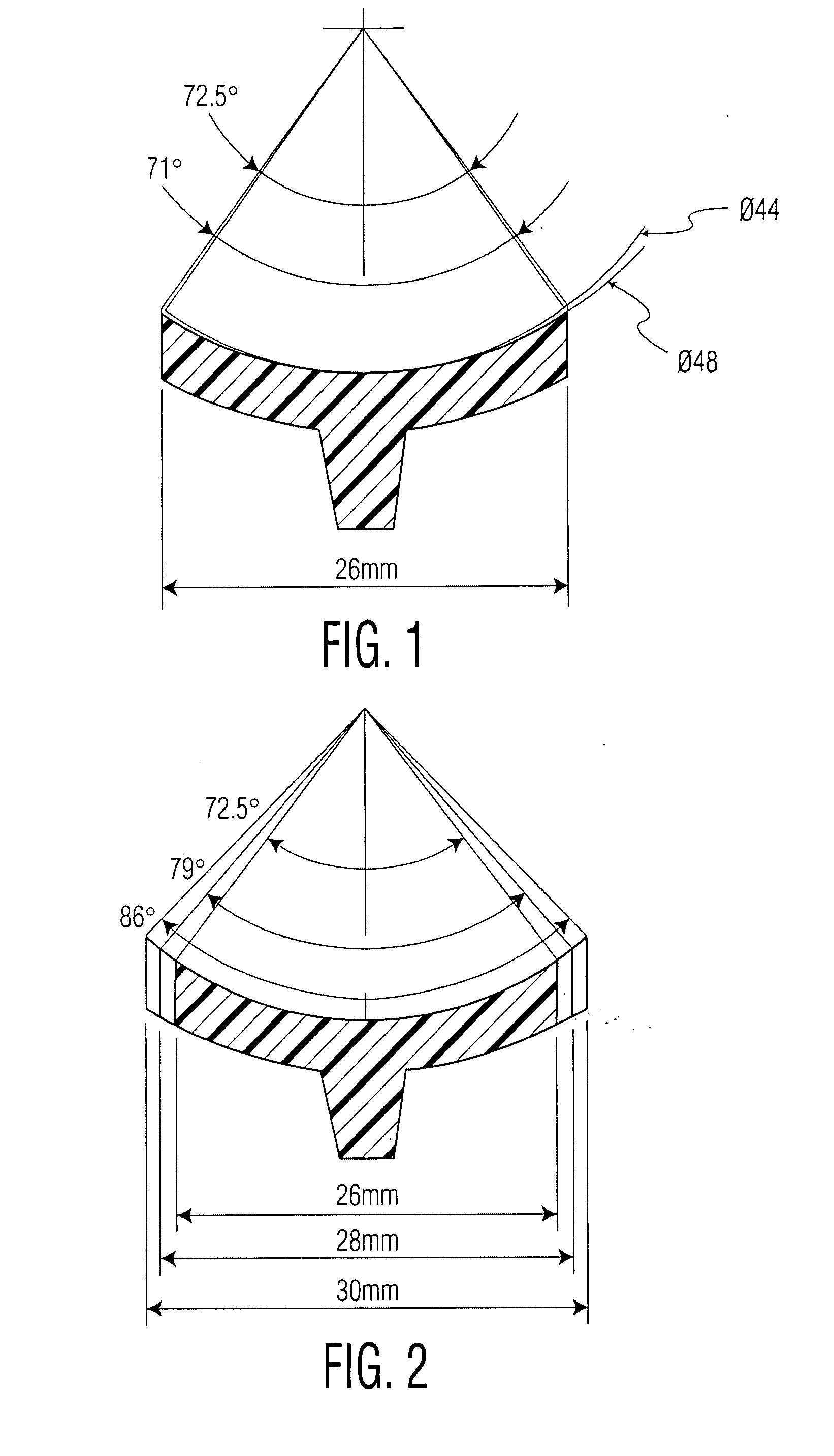 Prosthetic glenoid component