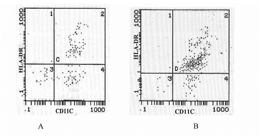 Preparation method of DCs, and application of DCs in preparing anti-tumor cell preparation