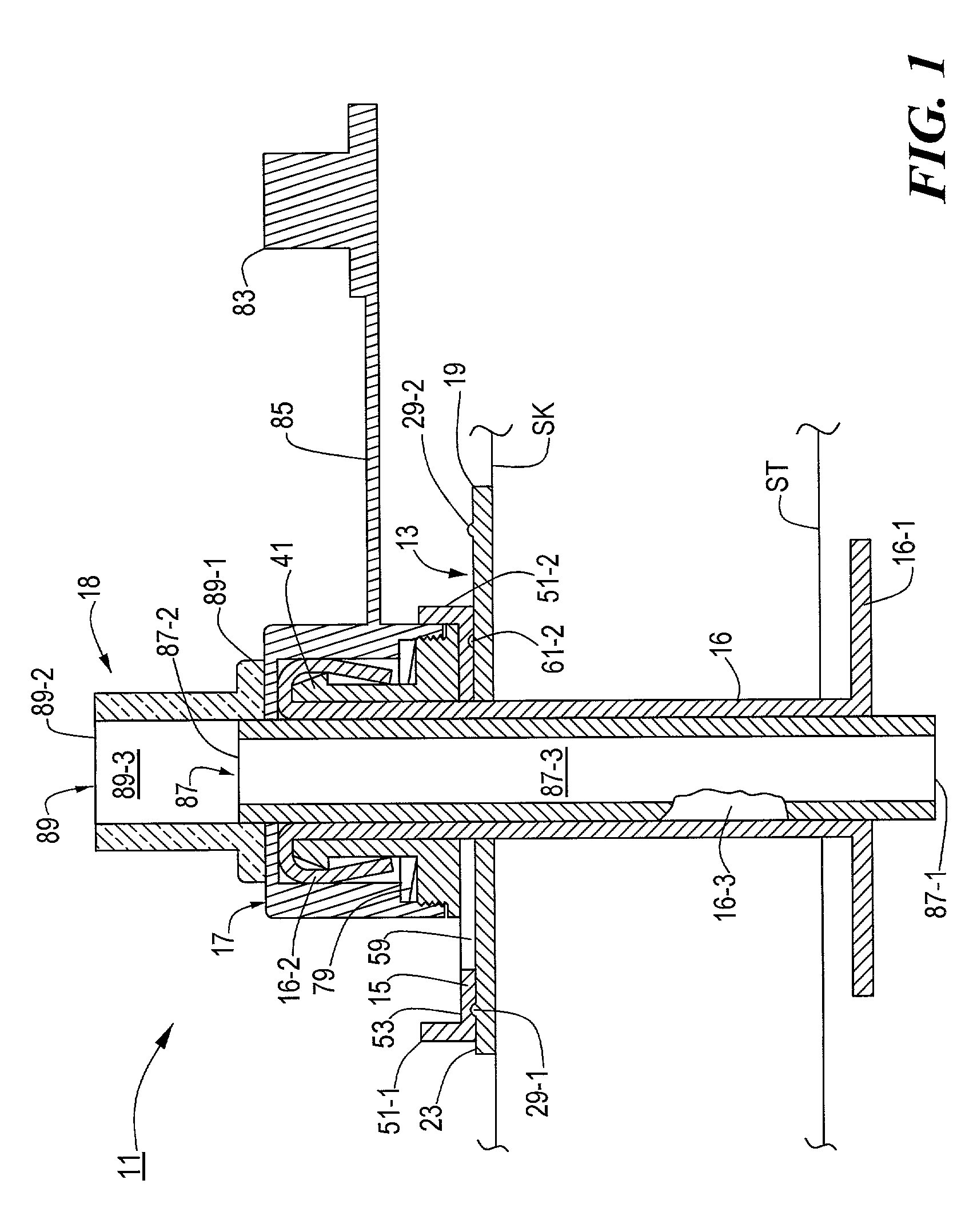 Medical catheter assembly including a removable inner sleeve and method of using the same