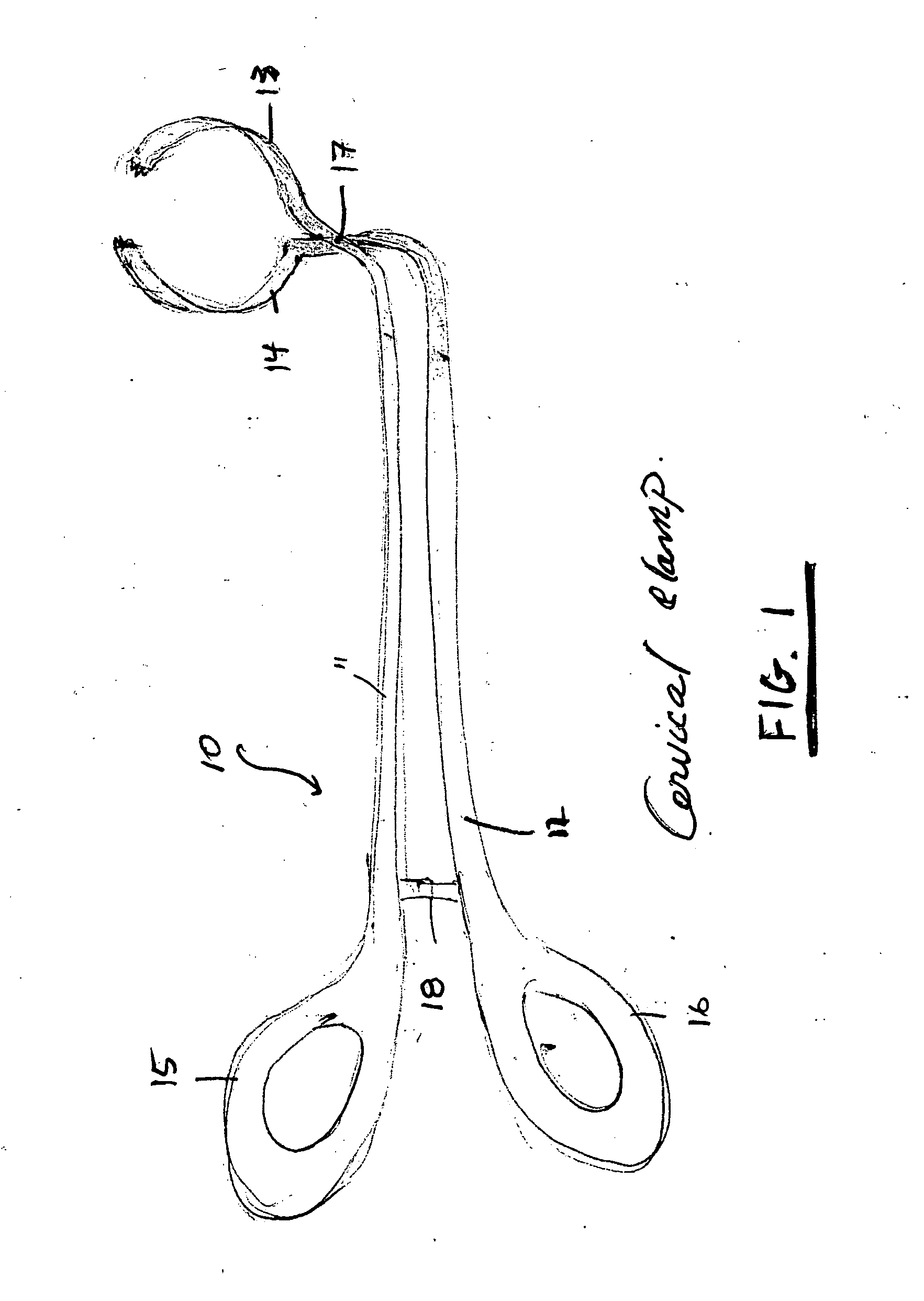 Device for sealing a cervical canal