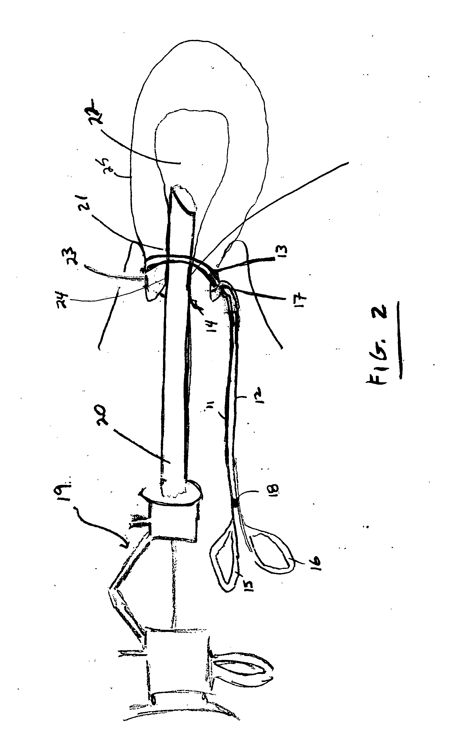 Device for sealing a cervical canal