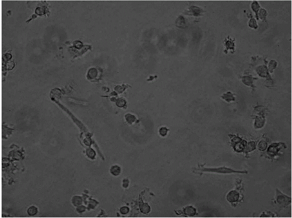 Method for preparing dendritic cell vaccine