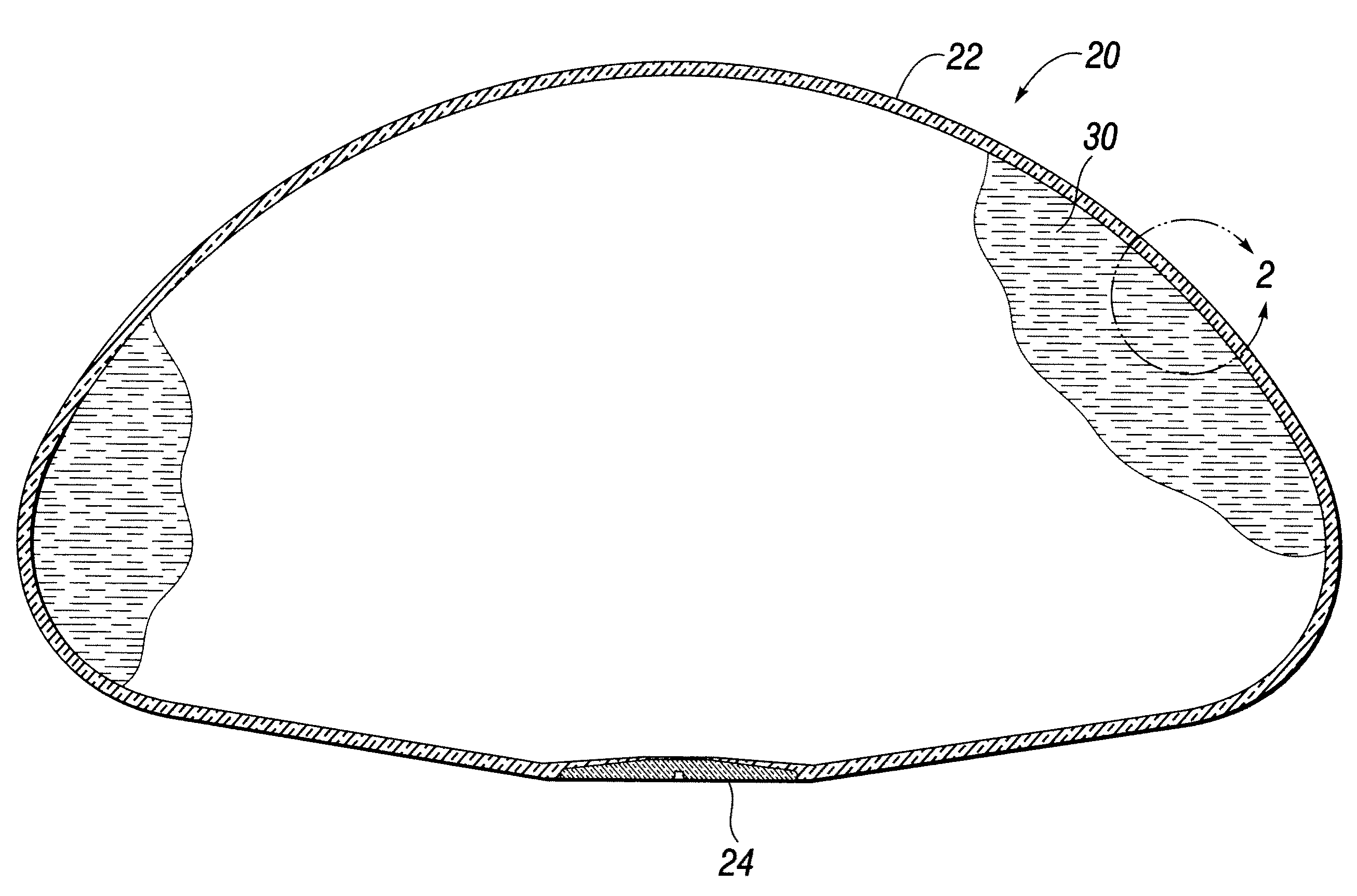 Self-sealing shell for inflatable prostheses