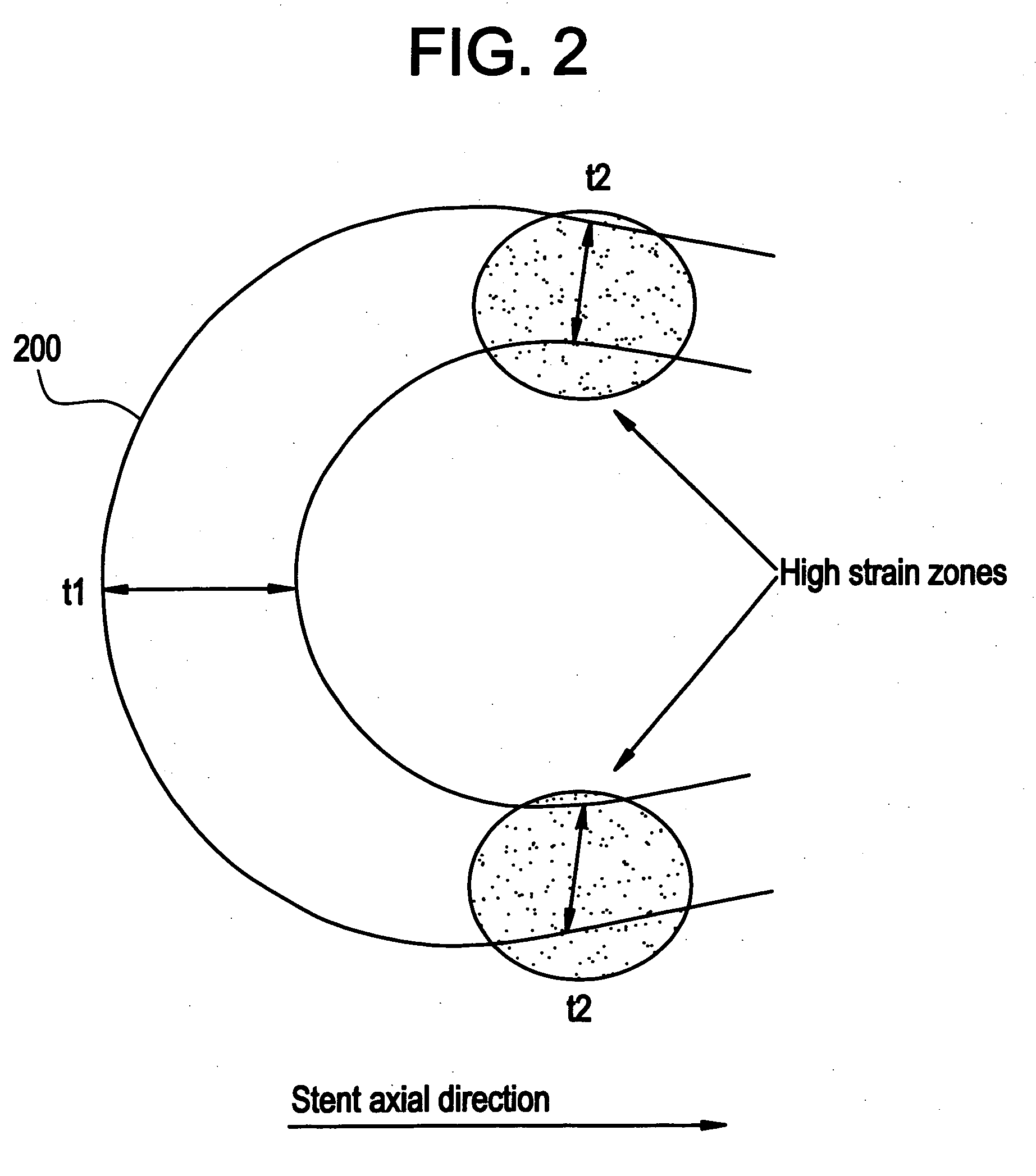 Polymeric stent having modified molecular structures in selected regions of the flexible connectors