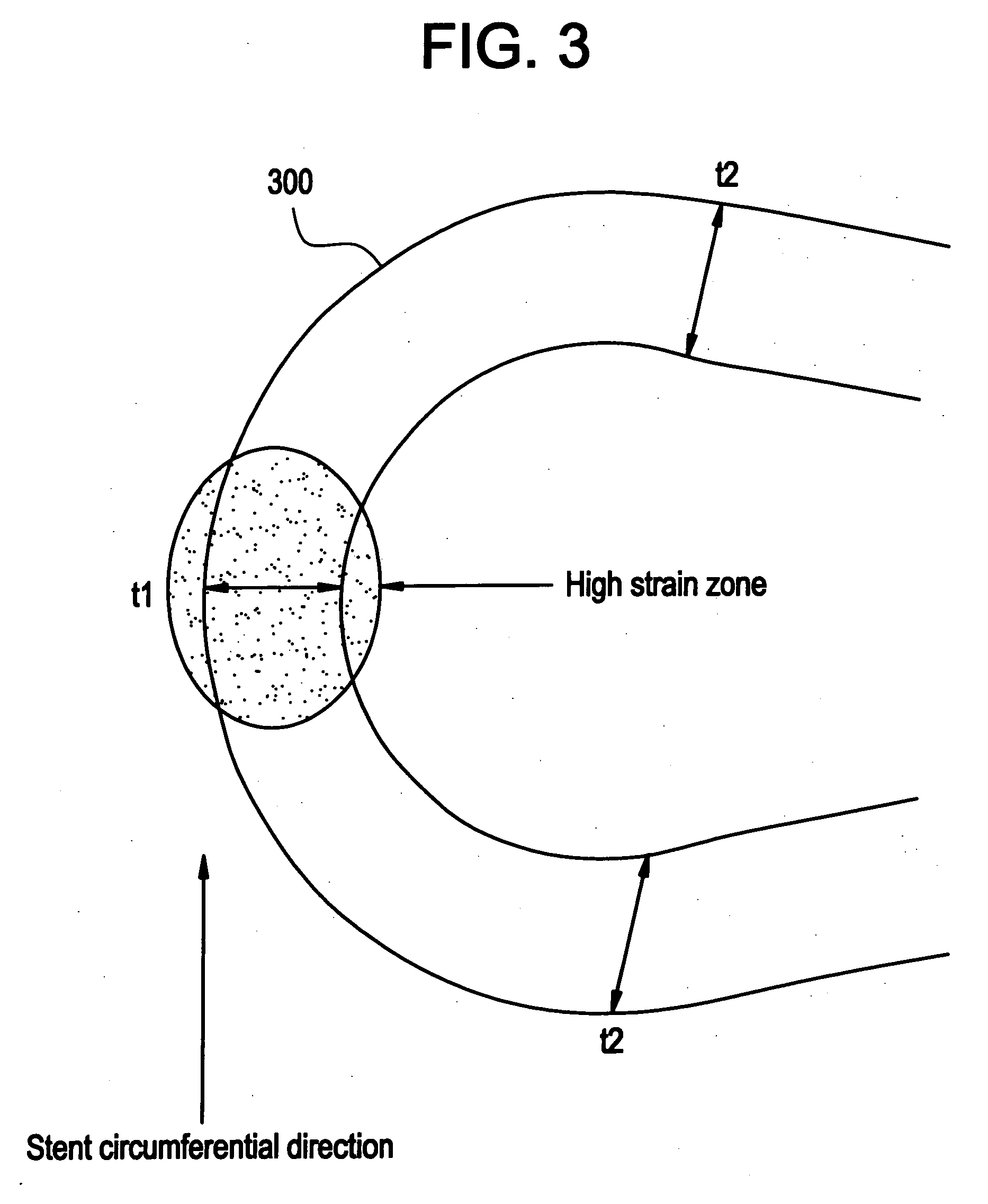 Polymeric stent having modified molecular structures in selected regions of the flexible connectors