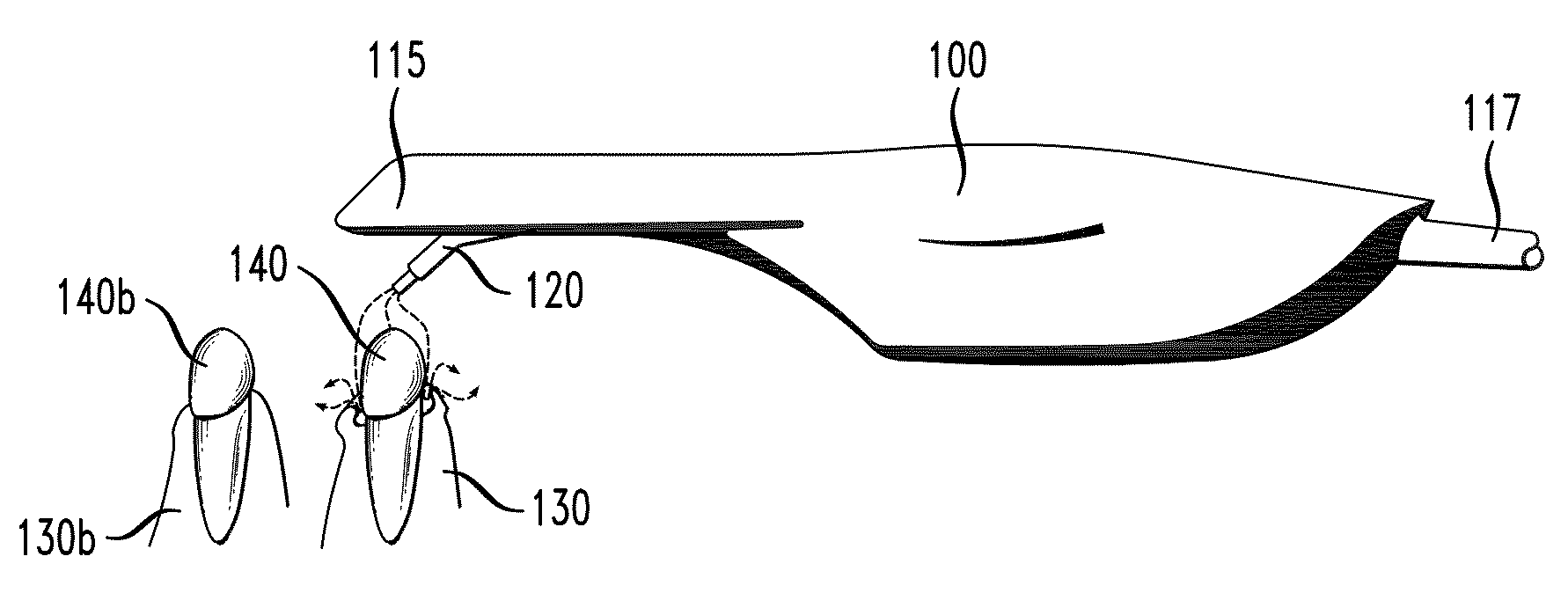 Intraoral scanner