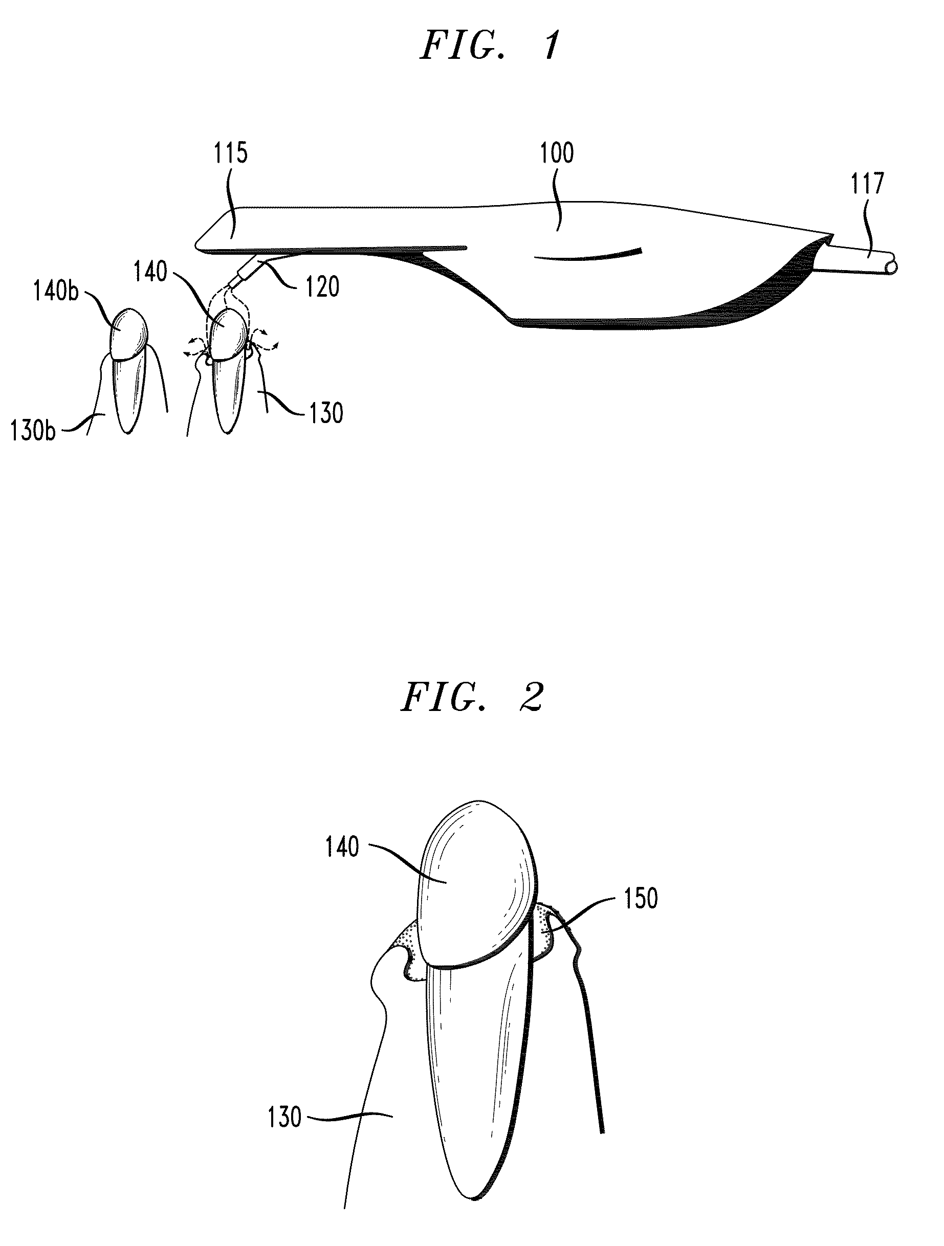 Intraoral scanner