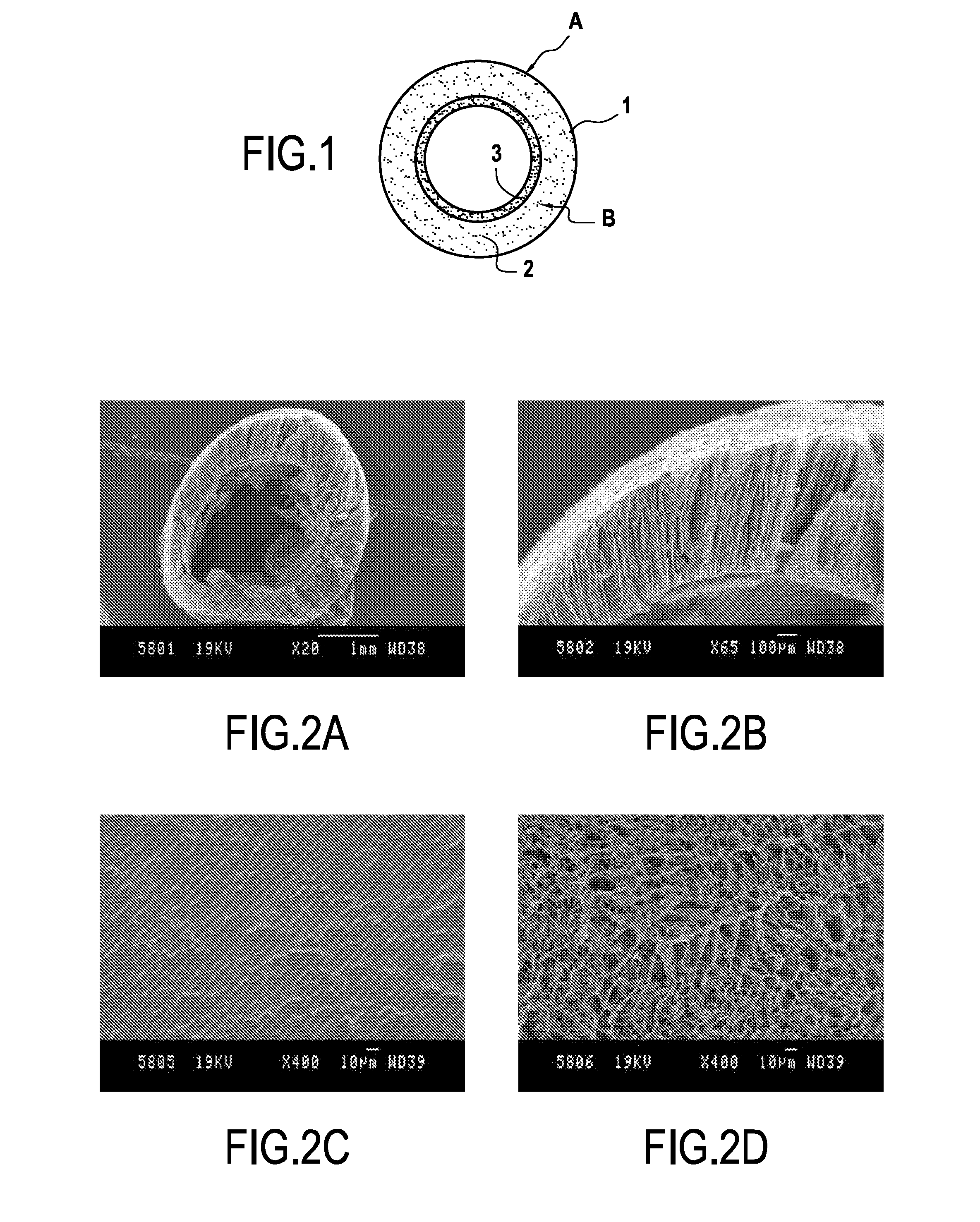 Prosthesis for promoting the in vivo reconstruction of a hollow organ or a portion of a hollow organ