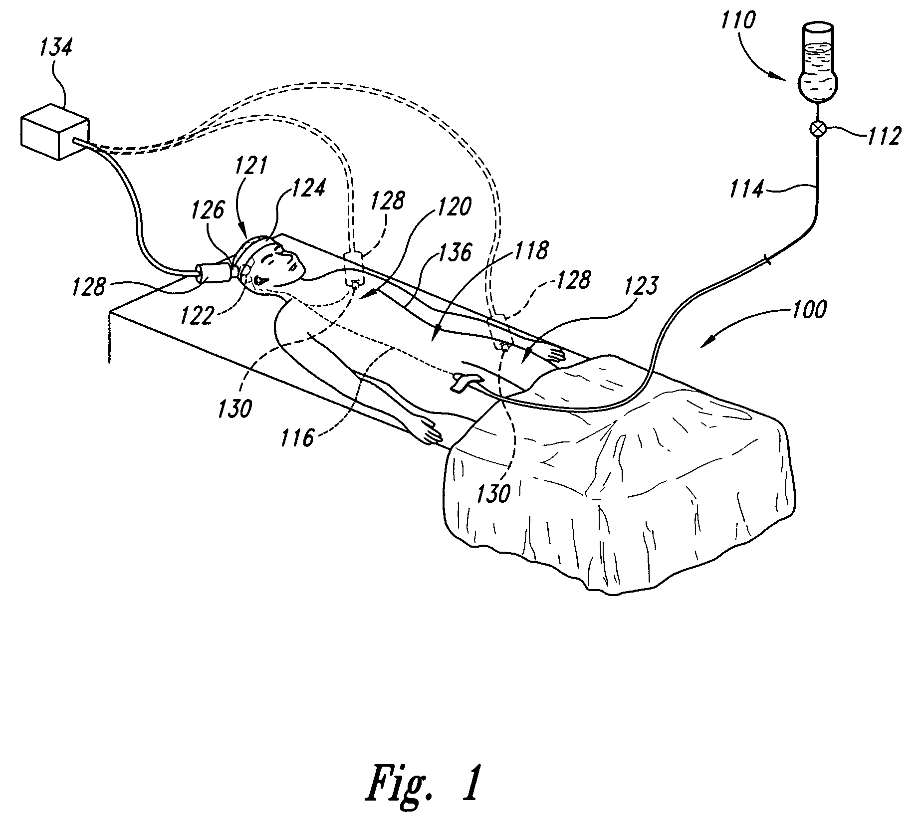 Method and apparatus for automatic location of blood flow with Doppler ultrasound