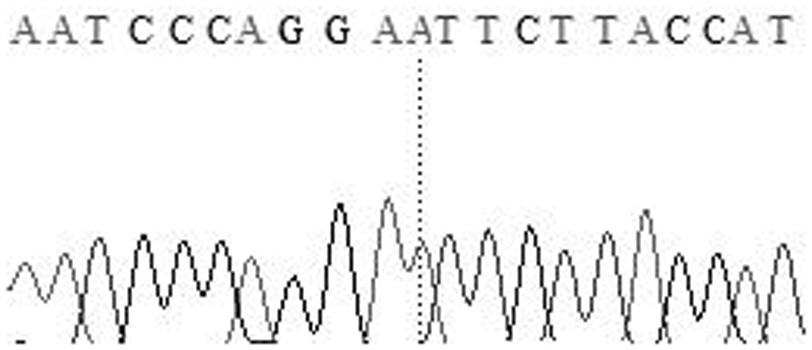 Molecular markers related to fiber diameter traits of sheep wool and their specific primer pairs and applications