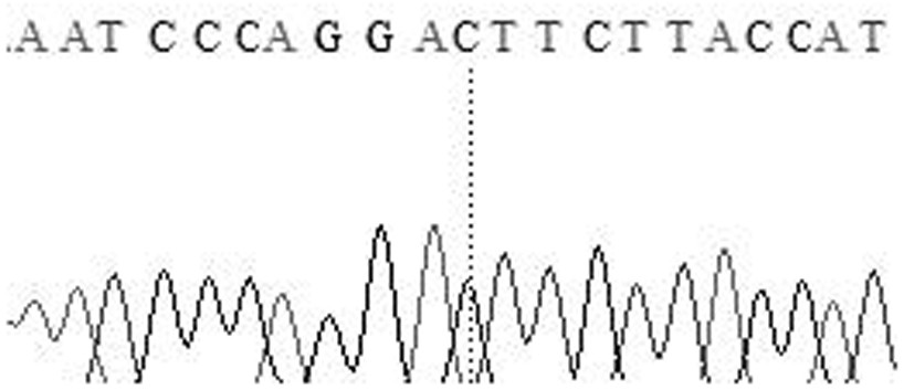 Molecular markers related to fiber diameter traits of sheep wool and their specific primer pairs and applications