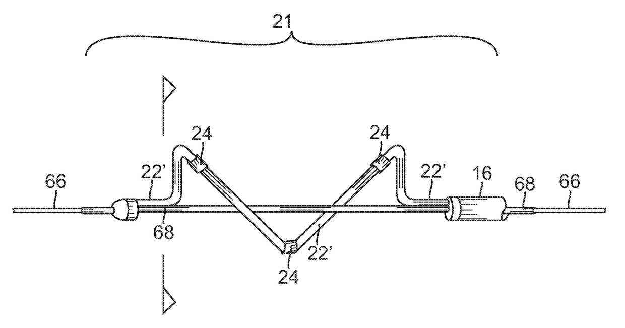 System and method for denervation